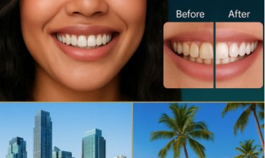 From Consultation to Perfection: Veneers by One Global Dental Specialist and Sands & Smiles