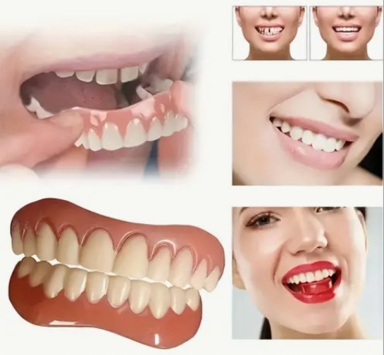 From Consultation to Perfection: Veneers by One Global Dental Specialist and Sands & Smiles